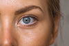 What Causes Wrinkles and Bags Around Your Eyes?